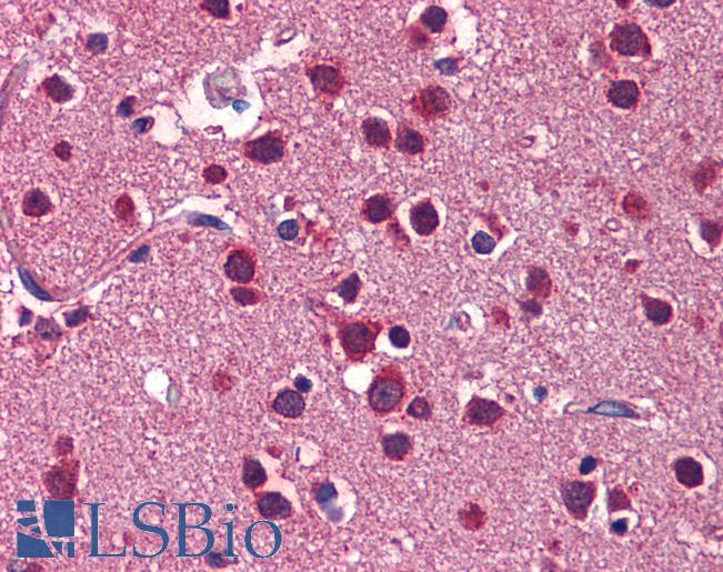 Anti-LSM1 antibody IHC of human brain, cortex. Immunohistochemistry of formalin-fixed, paraffin-embedded tissue after heat-induced antigen retrieval. Antibody LS-B5714 concentration 5 ug/ml.