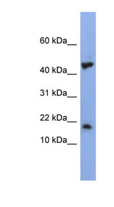 LSM1 antibody LS-B5714 Western blot of NCI-H226 cell lysate.