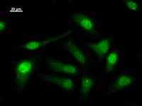 Immunostaining analysis in HeLa cells. HeLa cells were fixed with 4% paraformaldehyde and permeabilized with 0.1% Triton X-100 in PBS. The cells were immunostained with anti-LSM10 mAb.