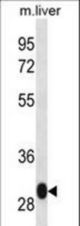 LSM12 Antibody western blot of mouse liver tissue lysates (35 ug/lane). The LSM12 antibody detected the LSM12 protein (arrow).