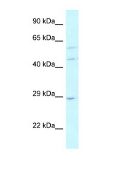 LSM14A antibody LS-C111626 Western blot of 721_B Cell lysate. Antibody concentration 1 ug/ml.