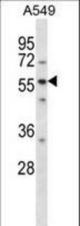 LSM14A Antibody western blot of A549 cell line lysates (35 ug/lane). The LSM14A antibody detected the LSM14A protein (arrow).