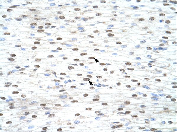 LSM2 antibody LS-C30554 was used in IHC to stain formalin-fixed, paraffin-embedded human heart.