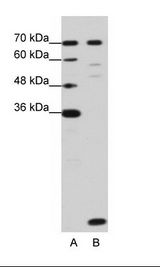 A: Marker, B: HepG2 Cell Lysate