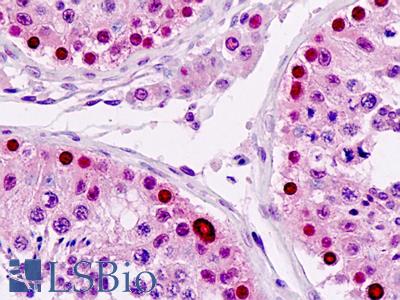 Anti-LSM2 / SnRNP antibody IHC staining of human testis. Immunohistochemistry of formalin-fixed, paraffin-embedded tissue after heat-induced antigen retrieval.