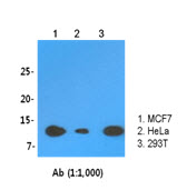 Western Blot: The cell lysates (30 ug) were resolved by SDS-PAGE, transferred to PVDF membrane and probed with anti-human LSm2 antibody (1:1,000). Proteins were visualized using a goat anti-mouse secondary antibody conjugated to HRP and an ECL detection system.