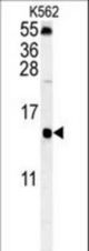 LSM4 Antibody western blot of K562 cell line lysates (35 ug/lane). The LSM4 antibody detected the LSM4 protein (arrow).