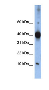 LSM4 antibody LS-C101866 Western blot of Jurkat lysate.
