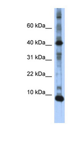 LSM6 antibody LS-C110557 Western blot of Transfected 293T cell lysate.