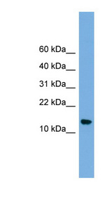 NAA38 / LSM8 antibody LS-C116183 Western blot of OVCAR-3 cell lysate.