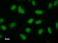 Immunostaining analysis in HeLa cells. HeLa cells were fixed with 4% paraformaldehyde and permeabilized with 0.1% Triton X-100 in PBS. The cells were immunostained with anti-LSM8 mAb.
