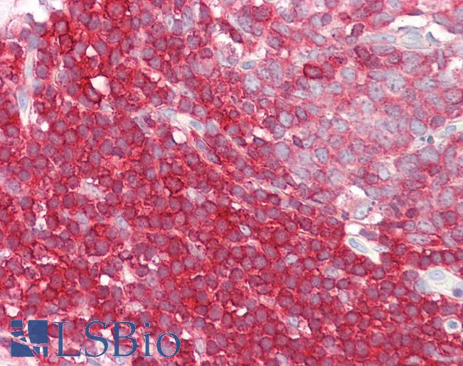 Anti-LSP1 antibody IHC of human colon, MALT. Immunohistochemistry of formalin-fixed, paraffin-embedded tissue after heat-induced antigen retrieval. Antibody LS-B8321 dilution 3.75 ug/ml.