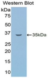 Western blot of recombinant LSR / LISCH7.