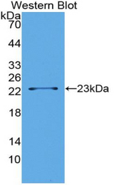 Western blot of recombinant LSR / LISCH7.