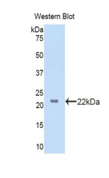 Western blot of recombinant LSS.