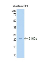 Western blot of recombinant LSS.