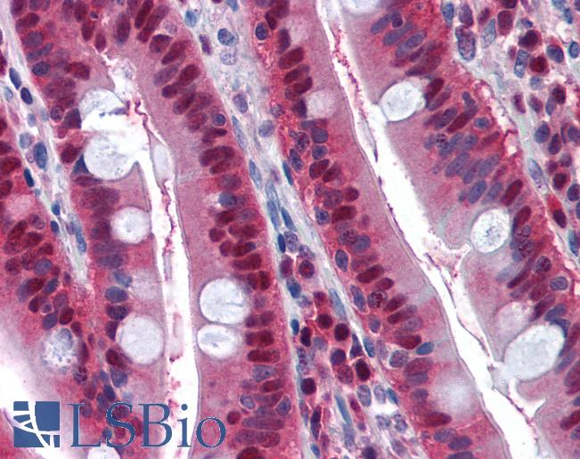 Anti-LTA4H antibody IHC of human small intestine. Immunohistochemistry of formalin-fixed, paraffin-embedded tissue after heat-induced antigen retrieval. Antibody LS-B1600 concentration 5 ug/ml.