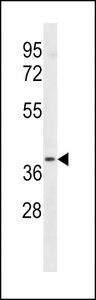 LTB4R2 Antibody western blot of A549 cell line lysates (35 ug/lane). The LTB4R2 antibody detected the LTB4R2 protein (arrow).