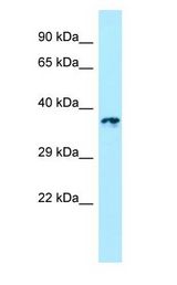 LTB4R2 / BLT2 antibody Western Blot of 721_B.