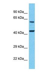 Western blot of LTB4R2 Antibody with human Placenta lysate.