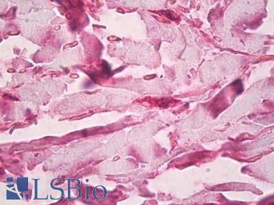 Anti-LTBP-1 antibody IHC of skin, dermal fibroblasts. Immunohistochemistry of formalin-fixed, paraffin-embedded tissue after heat-induced antigen retrieval. Antibody LS-B8256 dilution 5-10 ug/ml.