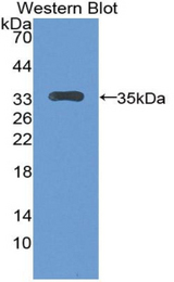Western blot of recombinant LTBP2.