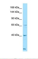 Western blot of Human ACHN. LTBP4 antibody dilution 1.0 ug/ml.