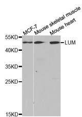 Western blot analysis of extracts of various cell lines, using LTBR antibody.