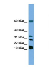 LTC4S antibody LS-C135219 Western blot of HepG2 Cell lysate. Antibody concentration 1 ug/ml.