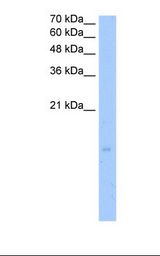 HepG2 cell lysate. Antibody concentration: 2.5 ug/ml. Gel concentration: 15%.