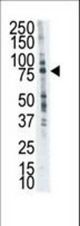 The anti-LTK antibody is used in Western blot to detect LTK in placenta cell lysate.
