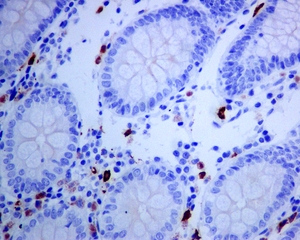 IHC of paraffin embedded human colon tissue using anti-LTK antibody.