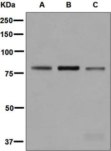 Western blot analysis on (A) Raji, (B) human tonsil, and (C) human spleen lysates using anti-LTK antibody.