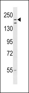 RNF160 Antibody western blot of NCI-H460 cell line lysates (35 ug/lane). The RNF160 antibody detected the RNF160 protein (arrow).