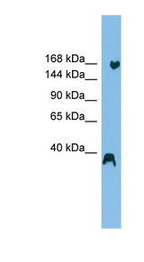 LTN1 / RNF160 antibody LS-C116229 Western blot of HepG2 cell lysate.