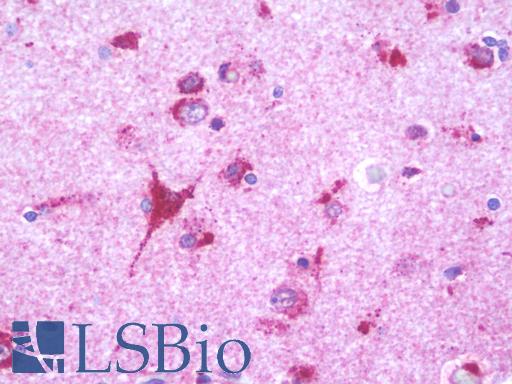 Human Brain, Cortex: Formalin-Fixed, Paraffin-Embedded (FFPE