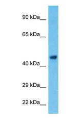Western blot of LC7L2 Antibody with human HeLa Whole Cell lysate.