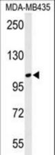Western blot of LUZP1 Antibody in MDA-MB435 cell line lysates (35 ug/lane). LUZP1 (arrow) was detected using the purified antibody.