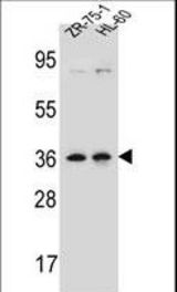 LUZP2 Antibody western blot of ZR-75-1,HL-60 cell line lysates (35 ug/lane). The LUZP2 antibody detected the LUZP2 protein (arrow).