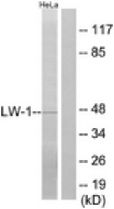 Western blot of extracts from HeLa cells, using LW-1 Antibody. The lane on the right is treated with the synthesized peptide.