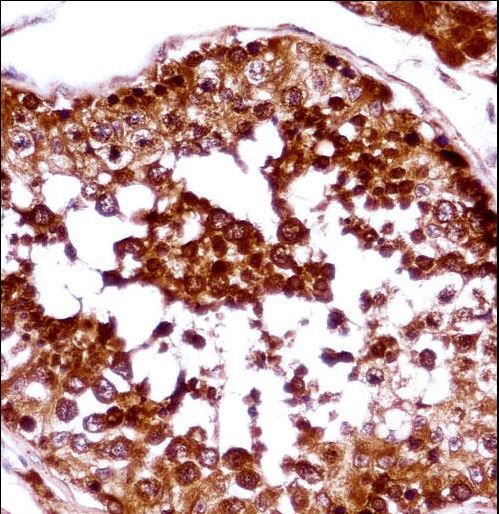 HSFX1 Antibody immunohistochemistry of formalin-fixed and paraffin-embedded human testis tissue followed by peroxidase-conjugated secondary antibody and DAB staining.