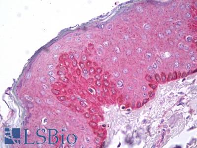 Anti-LY6G6F antibody IHC of human skin. Immunohistochemistry of formalin-fixed, paraffin-embedded tissue after heat-induced antigen retrieval. Antibody LS-B7529 concentration 10 ug/ml.