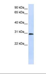 Placenta lysate. Antibody concentration: 1.0 ug/ml. Gel concentration: 12%.