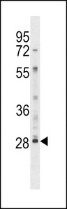 LY6G6F Antibody western blot of HL-60 cell line lysates (35 ug/lane). The LY6G6F antibody detected the LY6G6F protein (arrow).