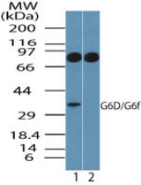 Western blot of G6D in human platelet lysate in the 1) absence and 2) presence of immunizing peptide using LS-C148408 at 1.0 ug/ml. Goat anti-rabbit Ig HRP secondary antibody, and PicoTect ECL substrate solution, were used for this test.
