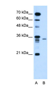 LY6G6F antibody Western blot of HepG2 cell lysate.