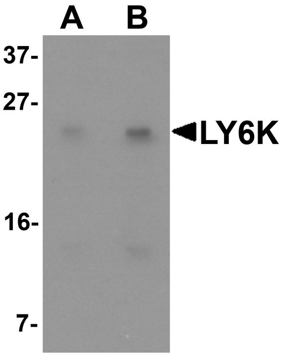 Western blot analysis of LY6K in HeLa cell lysate with LY6K antibody at (A) 1 and (B) 2 ug/ml.