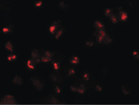 Immunofluorescence of SLAMF3 in 293 cells with SLAMF3 antibody at 20 ug/ml.