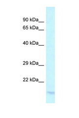 LY96 / MD-2 antibody LS-C145500 Western blot of PANC1 Cell lysate. Antibody concentration 1 ug/ml.
