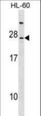 LY96 Antibody western blot of HL-60 cell line lysates (35 ug/lane). The LY96 antibody detected the LY96 protein (arrow).
